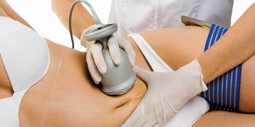 Non-Surgical Fat Reduction Cavitation at Pure Beauty Lounge, Hampton TW12