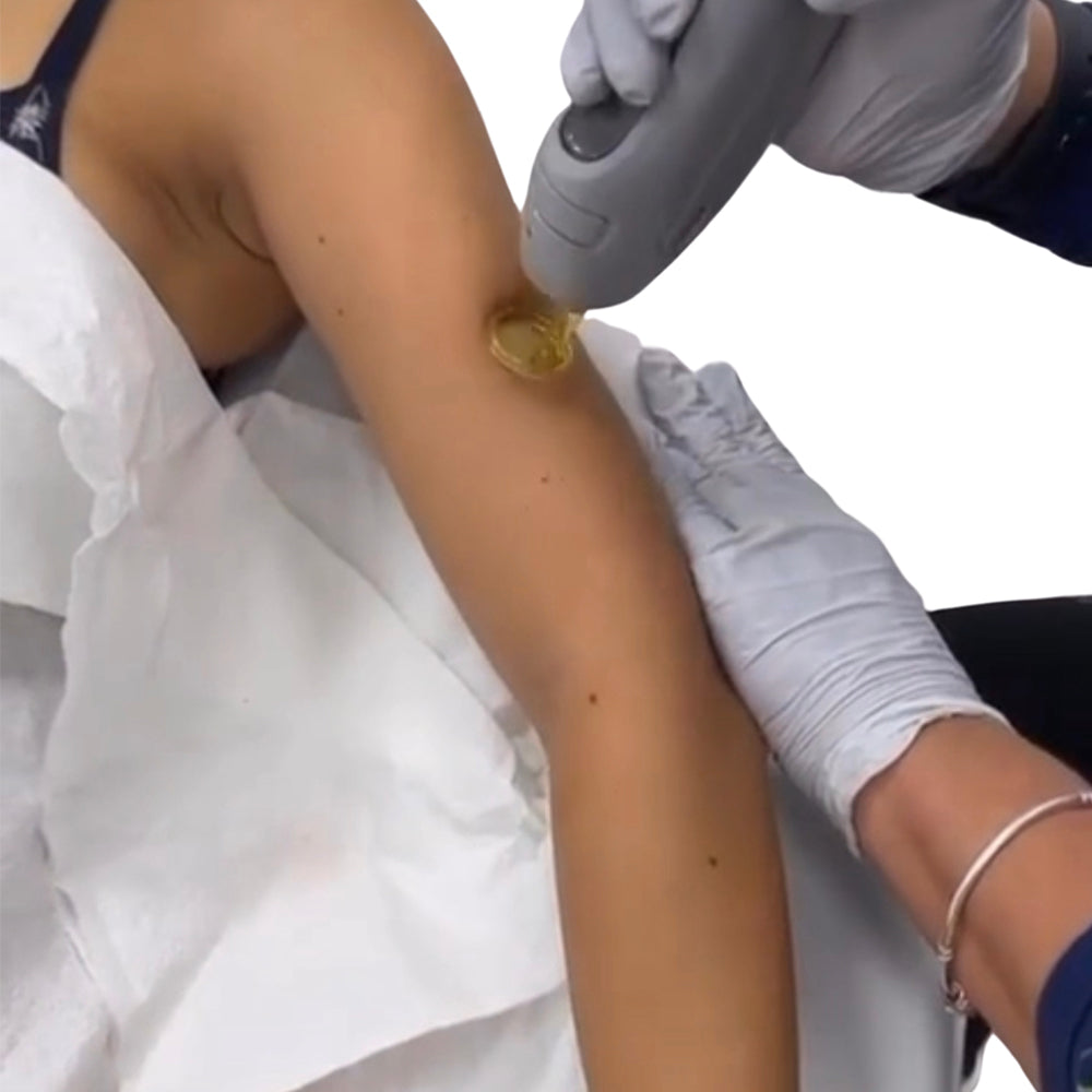 Full Arm Laser Hair Removal at Pure Beauty Lounge, Hampton TW12