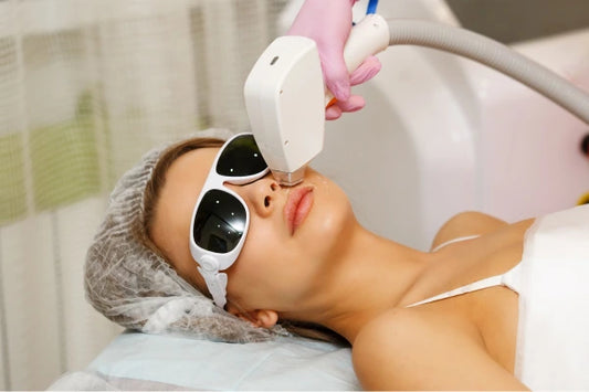 Laser Hair Removal - Upper Lip