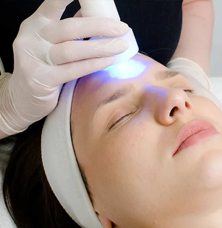 Microneedling + LED Light