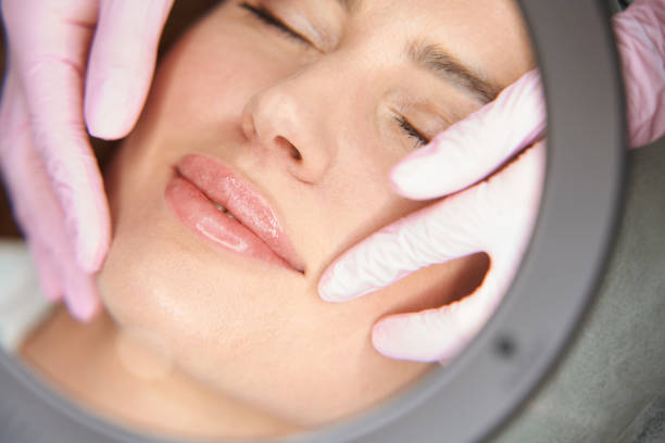 0.5ml Lip Filler