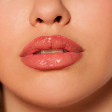 1ml Lip Filler