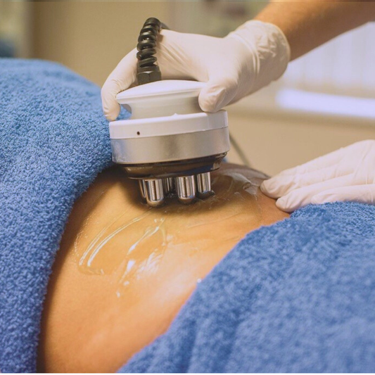 Radiofrequency – Large Area – Package of 6