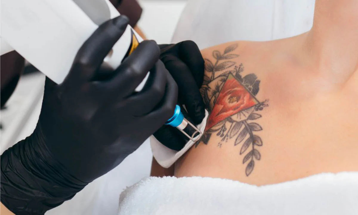 Tattoo Removal Treatment at Pure Beauty Lounge, Hampton TW12